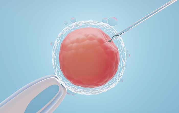 IVF Treatment